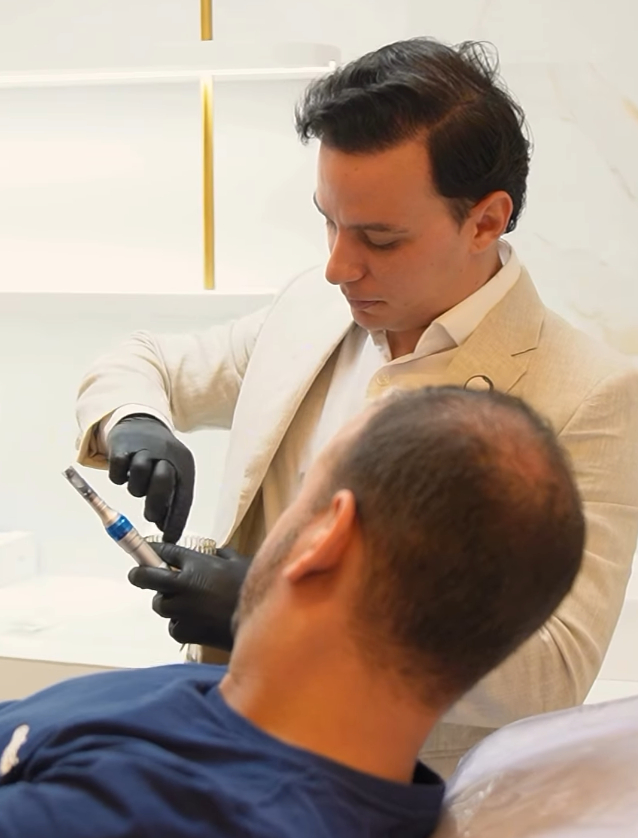 Dr. Lucas Moura em procedimento de transplante capilar DHI: traje bege, luvas pretas, segurando o Choi Implanter sobre a área receptora do paciente em ambiente clínico.